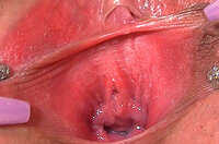Free Gape My Pussy Discount Trial s2